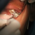 Implant Technology